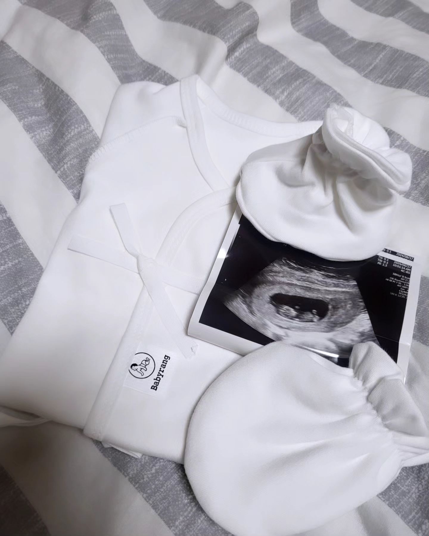 안녕 아가야~~๑ᴖ◡ᴖ๑
첫아이 너무 늦은나이 계획 임신준비였지만
한번에 찾아와준 아가야 너무 고마워..
임신초기부터 우여곡절 힘든 일도 있었고
큰병원도 가야하는 마음졸이는 일이 있었지만
다행히 너는 더 ~~~ 잘 자라주고 있었어.. ^^

병원 갈때마다 아빠가 옆에 있어줘서 고맙고 
같이 지켜보면서 점점 커가는 한방이를 보니
아빠가 좀 눈물을 보일까했는데 
눈물은 잠시 아껴두는듯 하네^^

입덧도 없어서 아주 편하게 지나가고 있는것 같아.. 
아직까지는??·ᴗ·
아들이든 딸이든 내가 너를 이세상에
초대했으니 널 꼭 지켜줄께!

누굴 더 닮았을지 너무너무 기대되네~~˃ᴗ˂
앞으로 남은날까지 내품에 찰싹 붙어있다가 나와줘
한방아❤

#안녕아가야 #반가워 #곧13주#태명#한방이#맘스타그램 #뱀띠#임신#복덩이#임신12주#3개월#자연임신#30대임산부#임산부12주#2025뱀띠#25년생#4개월#초음파#임신부소통
