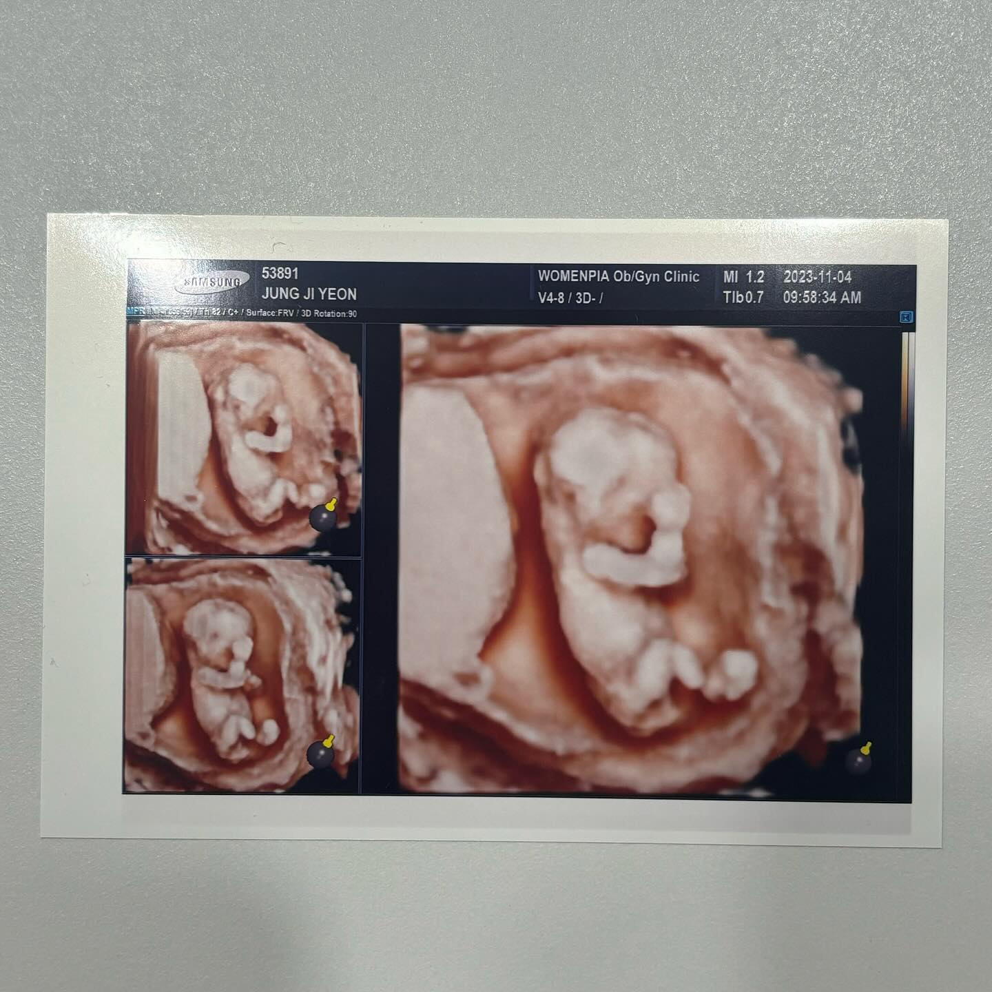 #임밍아웃
_
하나님께서 귀한 생명 ‘꿀떡’이를 쩡쩡부부에게 보내주셨어요🍼
꿀떡이가 온 뒤로 신기하고 놀랍고 아슬아슬한 하루를 보내고 있어요😍

[어설픈 임밍아웃 이벤트🎉]
1차 - ”국 끓였어, 간봐줘~“ 영상 못남김😭
2차 - 1차 이벤트가 끝인줄 알았나보다. 방문 앞에서 호떡 얘기만 3분을 하는 남편🥲
호떡 한장에 1,700원이 충격이었나보다🌸

40주까지 무탈하고 행복하게 보내자
사랑해, 꿀떡🍡
_
#이벤트 #태명 #12주 #16주 #입체초음파 #부부의세계 #2세 #임신스타그램 #임산부 #쩡쩡오메가