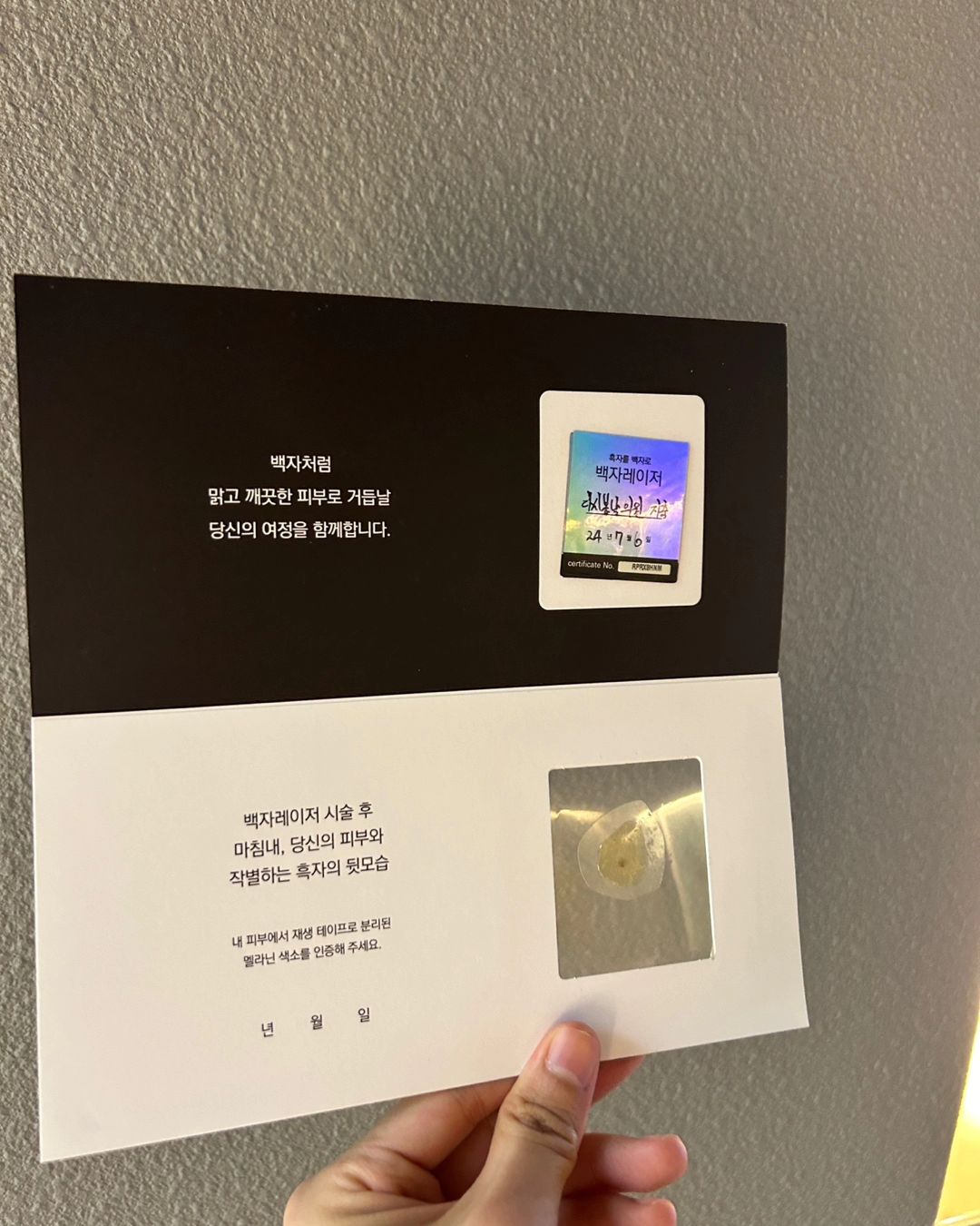 계속 신경 쓰였던 피부에 갈색반점을 빼고 왔어요!!!!
피부의 거뭇거뭇한 부분이 신경 쓰였는데
상담 받아보니 리팟레이저로 흑자를 한번에 뺄수 있다고 해서
제거 하고 왔는데 듀오덤을 2주동안 붙이고 있다가
떼어내면 흑자도 같이 떨어져 나가서 넘 신기하더라구요ㅋ

피부가 이렇게 쉽게 깔끔해 지는거 였다면
진작 할껄 그랬어요!!!!

백자레이저 캠페인 중이라 저도 참여해 봅니다😀

#백자레이저 #리팟레이저 #리팟 #reepot #백자레이저캠페인 #백자캠페인 #흑자 #흑자제거 #흑자 #검버섯 #오타모반 #잡티 #잡티제거 #밀크반점 #밀크커피반점 #커피반점 #카페오래반점 #주근깨 #얼굴착색 #색소침착 #색소치료 #색소질환 #피부과 #피부과시술추천 #피부과시술 #피부관리 #지축피부과