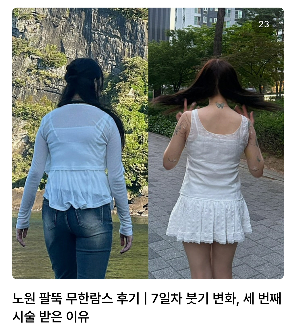 콘텐츠