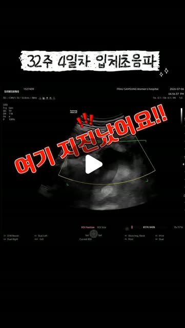 콘텐츠