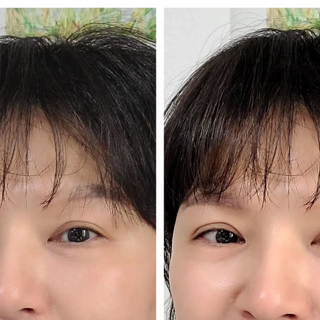#광고 @3wclinic.official

피부 장벽 무너졌을 때, 바르는
이지트라(EGTRA-D) .ᐟ.ᐟ.ᐟ

​고기능성 성분들이 가득~
놀라울 만큼 흡수력 빠름!

메이크업 전에 발라도 
쫀쫀하게 착붙.ᐟ.ᐟ.ᐟ

​◾ EGF 5ppm 고함량: 시중 대비 
50배! 장벽 회복의 핵심.ᐟ
◾ 기미/잡티 지우개: 트라넥삼산 & 
나이아신아마이드 각 20,000ppm 함유.ᐟ
◾ 진정 끝판왕: 정제수 대신 
병풀잎수 660,000ppm.ᐟ
◾ 안심 성분: 전성분 EWG 그린 등급
+ 식약처 인증 미백/주름 개선.ᐟ

​끈적임 없이 피부 속부터
탄탄하게 채워주는 재생크림👧🏻👍🏻

네이버 단독판매 중이니
네이버에서 [이지트라 크림] 검색
.
.
#이지트라크림 #EGF재생크림 #착색크림 #트라넥삼산크림
